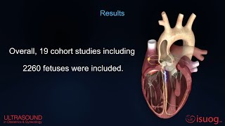 Video Abstract: fetal premature atrial contractions