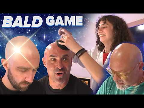 Scientifically Measuring Who's The Most Bald