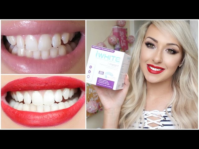 Maryanne Jones Schurk snor How I Whitened My Teeth at Home using iWhite| Dramaticmac - YouTube