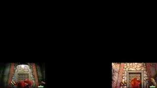 Remake Me Listen Me Remember And Me Leap Sparta Venom Remix -Ab75E-