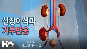 신장이식과 거부반응 - 741회 (20.07.29) 면역이 관용을 허락하는 시간