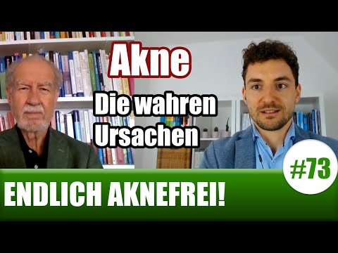 Akne behandeln - Die wahren Ursachen von Akne und Pickeln |Spitzen-Gespräch mit Prof. Dr. Jörg Spitz