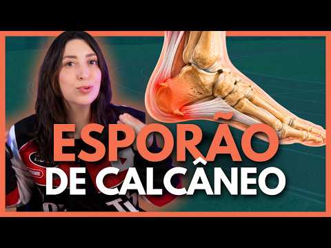 ANATOMY OF RUNNING INJURIES: Heel Spur