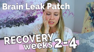RECOVERY PART 2 // The Symptoms that my First Blood Patch FAILED