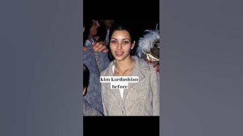 Thumbnail of kardashians before and after surgery #shorts #edit #kardashian #kylie  #kimkardashian  #kendall