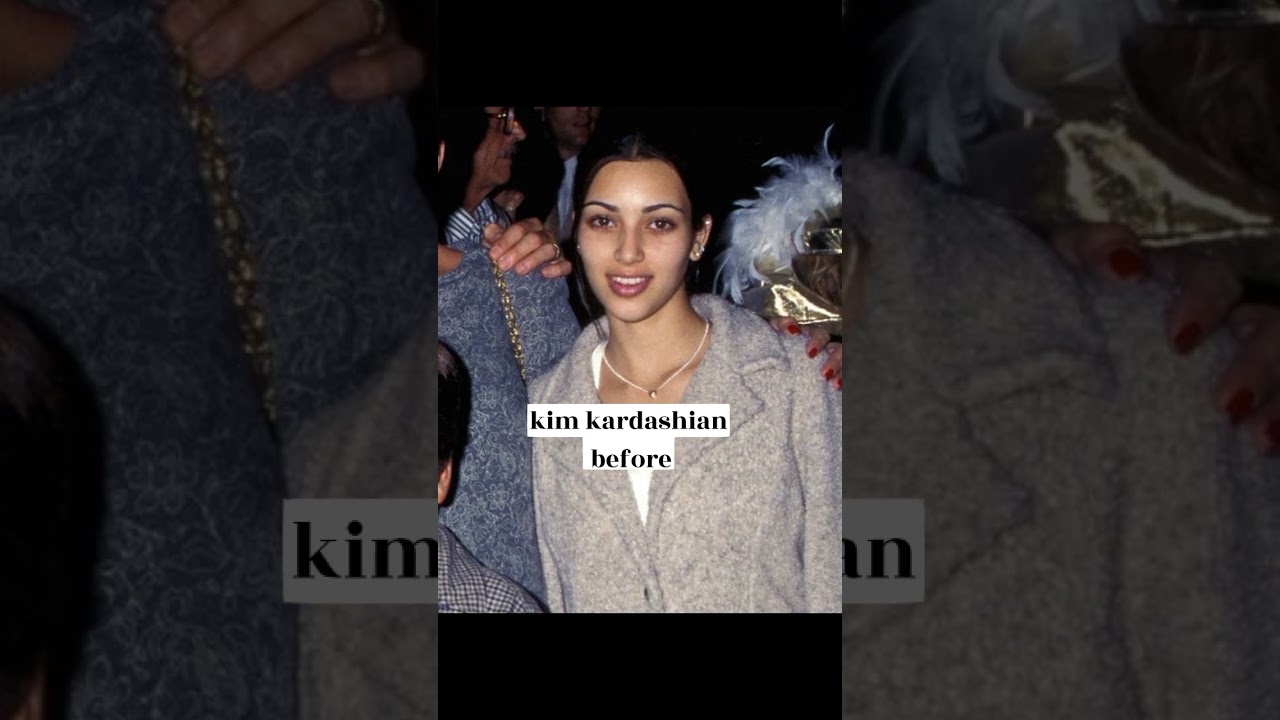 ⁣kardashians before and after surgery #shorts #edit #kardashian #kylie  #kimkardashian  #kendall