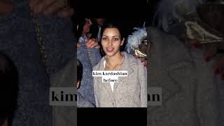 kardashians before and after surgery #shorts #edit #kardashian #kylie  #kimkardashian  #kendall screenshot 3