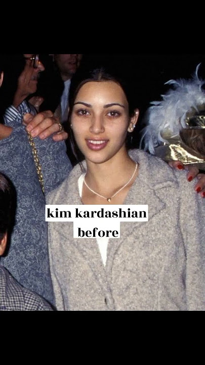 kardashians before and after surgery #shorts #edit #kardashian #kylie  #kimkardashian  #kendall