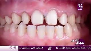 برنامج صباح الخير لقاء د.مؤيد الزيبادي