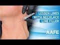 Lessen Lines with Necklace Line Filler