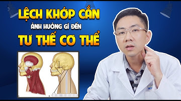 Sai Lệch Khớp Cắn Ảnh Hưởng Gì Đến Tư Thế Cơ Thể?
