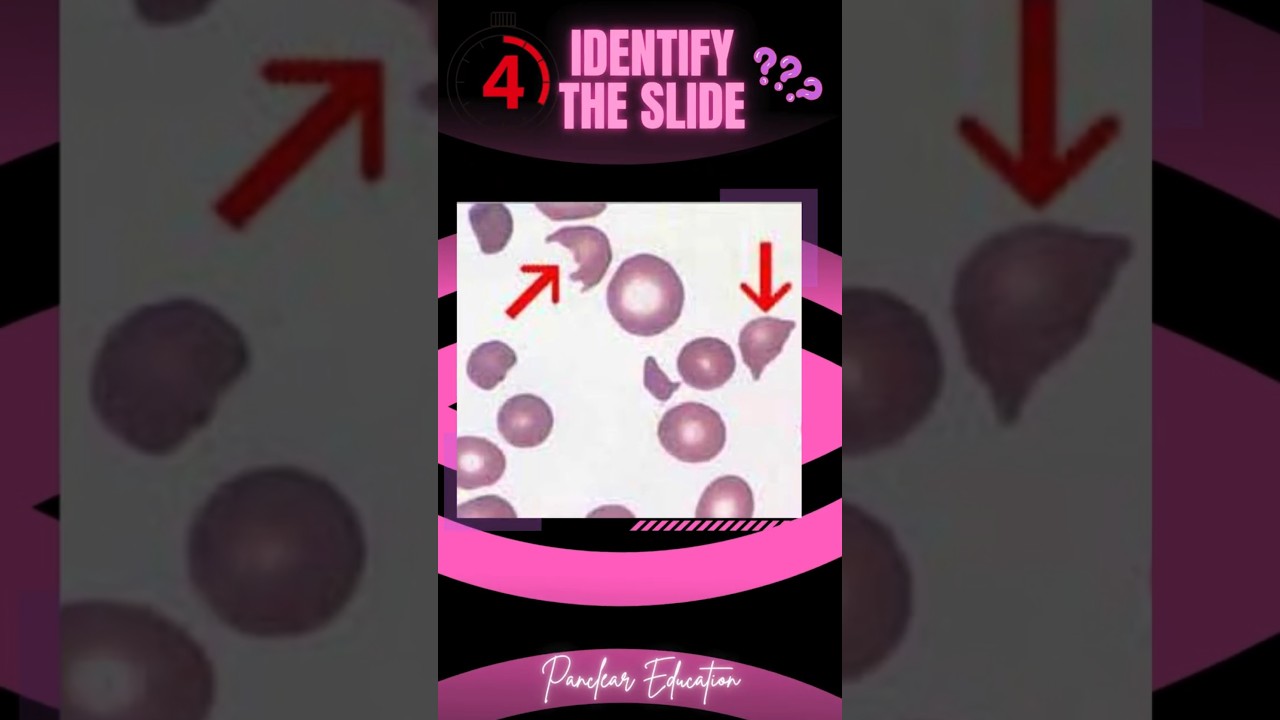 Identify The Slide! | Pathology Slides | 