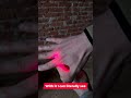 Što laser radi ljudskom tkivu? (450nm vs 650nm)