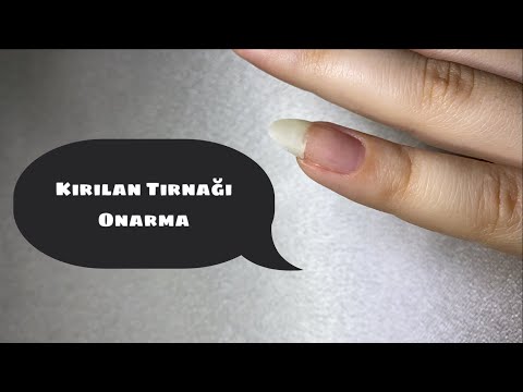 Video: Kırık olan tırnaklar düzeltilemez mi?