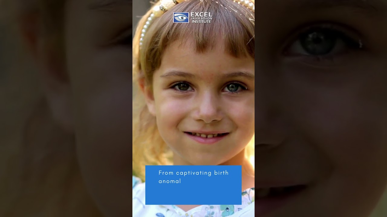 Exploring the Mystique of Heterochromia Unveiling the Beauty of Diverse Eyes