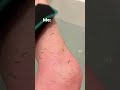 میں نے لوفا سے ڈیپ ایکسفولیٹنگ باڈی اسکرب گلوو پر کیوں سوئچ کیا 