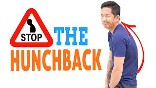 How to Prevent Hunchback Posture - FIX KYPHOSIS BEFORE IT STARTS