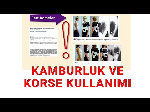 KORSE KULLANARAK KAMBURLUĞU AZALIR MI?