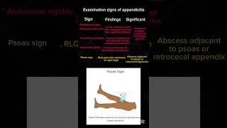⚡️ Examination signs of appendicitis #step2 #usmle #shorts