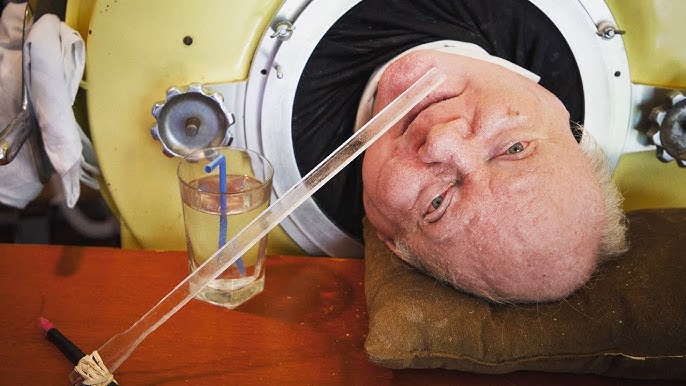 Longest Living Polio Survivor In Iron Lung Dead At 78