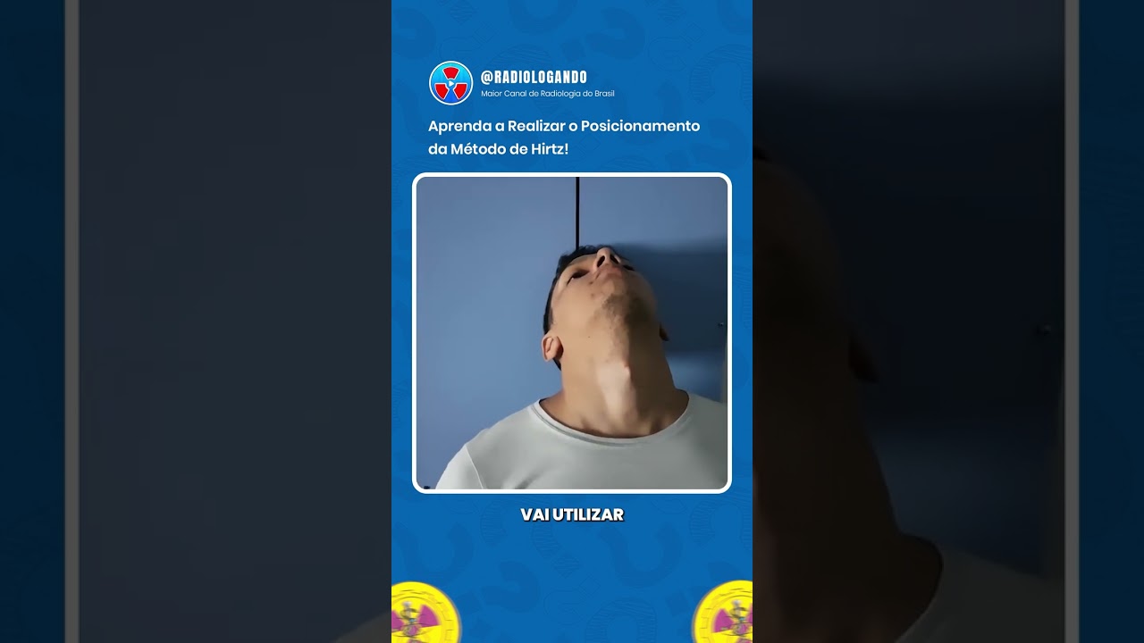 POSICIONAMENTO: MÉTODO DE HIRTZ