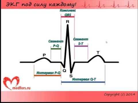 Видео: Урок 2. Видеокурс "ЭКГ под силу каждому".