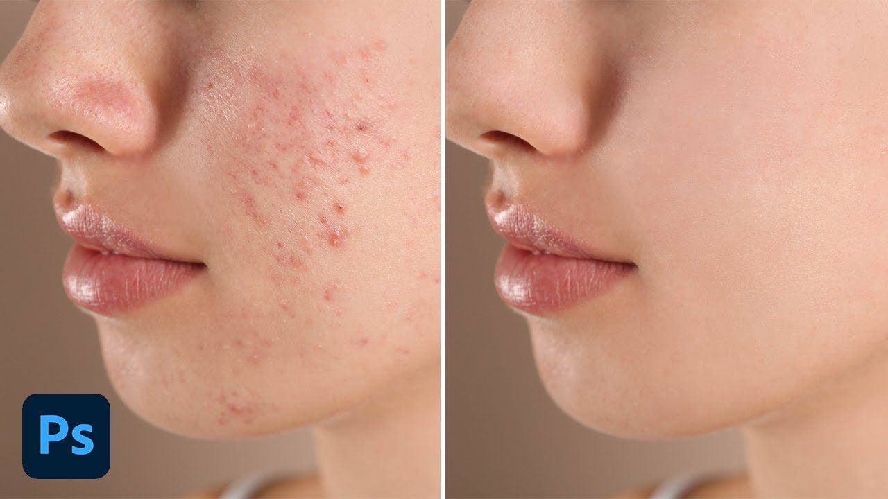 Acne photoshop download flourish motion graphics animation after effects free download