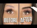 Remove Tattoo From Eyebrow