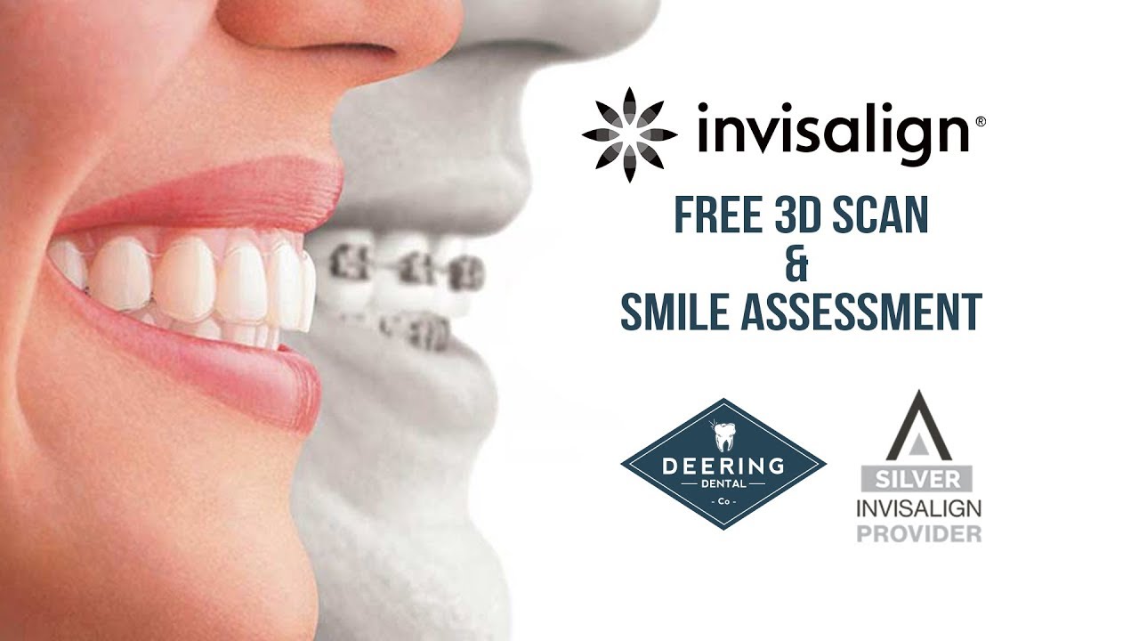Free Invisalign 3D Scan & Smile Assessment by Deering Dental in Palmetto Bay