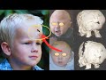 Boy Hits His Head and Feels Dizzy, What Doctors Find Next Will Shock Them!