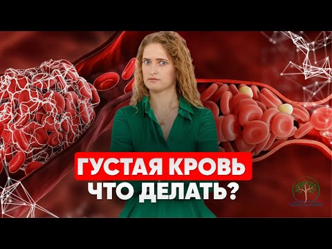 Как разжижать кровь без таблеток? Причины густой крови. УБИРАЕМ СМЕРТЕЛЬНЫЕ РИСКИ