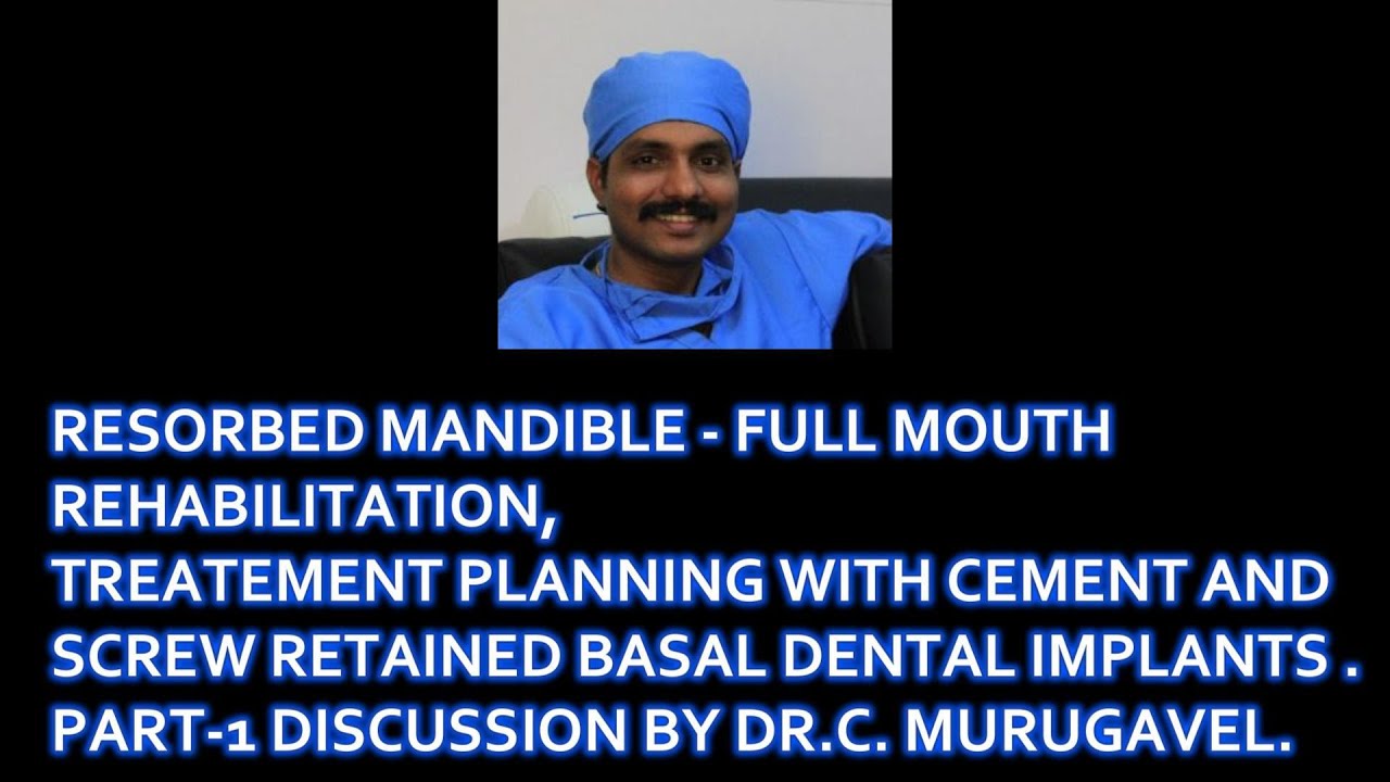 Resorbed mandible full mouth rehabilitation treatment planning ,cement ...