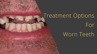 Worn Teeth - What You Can Do (and should you worry about thinning teeth?)