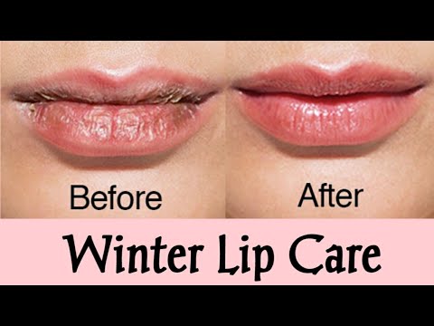 Video: Women Were Reminded How To Paint Flaky Lips In Winter