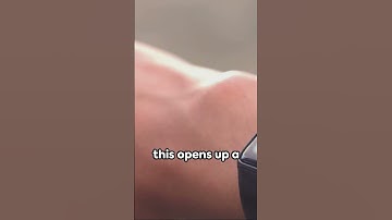 🚀🩺 Wearable Wonders: The Rise of Miniaturized Impedance Sensors!