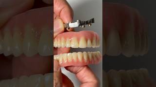 SYTON 3500 with Locators for Dr. Chris Davenport in Virginia
