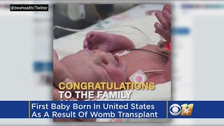 First Baby From A Uterus Transplant In The US Born In Dallas