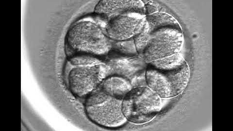Embryoscope timelapse