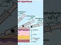 Injection types#pharm easy learn #pharmacy shorts