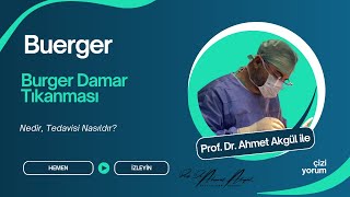 Buerger Hastalığında Kangren Önlenebilir Mi? Erken Tanının Önemi - Prof. Dr. Ahmet Akgül