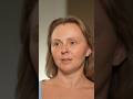 Людей очень много обманывали как инъекционными процедурами с фотошопом, разным светом и фотографиями