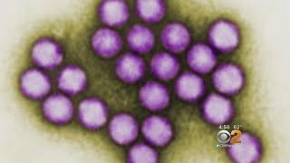 N.J. Health Dept.: 6 Children Dead Due To Outbreak Of Adenovirus