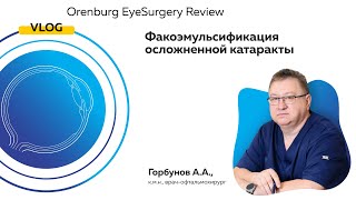 Факоэмульсификация осложненной катаракты