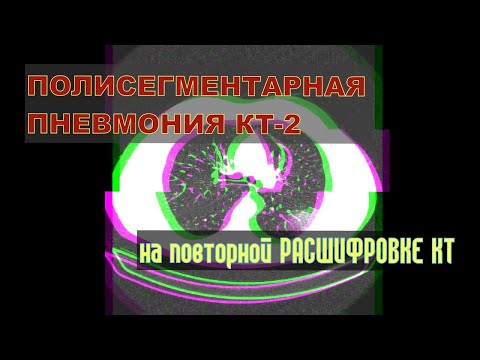 Видео: Тежка кашлица при дете: причини и лечение