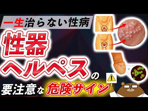 一生治らない【不治の性病】  性器ヘルペスが怖すぎる件