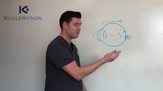 "I can't have LASIK because I have astigmatism." Truth or Myth?