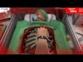 تجربة لعبة الجراحة Surgeon Simulator سوينة جراحة للقلب تجربة لعبة الجراحة Surgeon Simulator سوينة جراحة للقلب