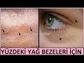 YÜZ Ve GÖZ ÇEVRESİ YAĞ BEZELERİ İÇİN DOĞAL ÇÖZÜMLER-GÜZELLİK-BAKIM