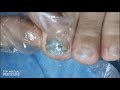 Clip toe nail with a big diamond