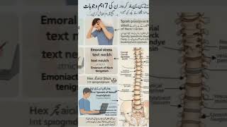 Neck stiffness